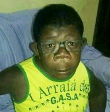 Ребенок &quot;родился&quot; от шимпанзе: в Анголе эксперты проверяют гены мальчика